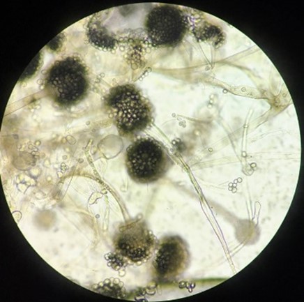 Nấm mốc Rhizopus 2