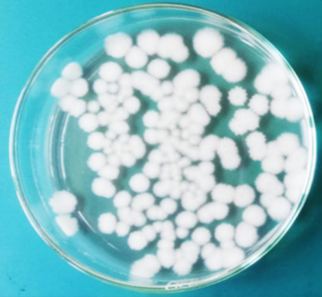 Vi khuẩn Bacillus